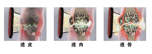 大连华联善古堂能治腰病吗 透骨外敷搞定老腰病