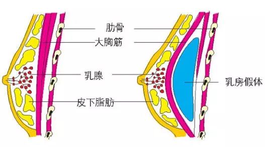 上海自体隆胸玫瑰医院怎么样  女人应该慢慢习惯用健康上妆