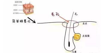 北京伊美尔爱康医院:超微小气泡是什么