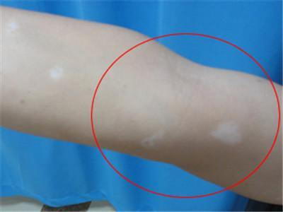 人ǰҽԺǷнݾ·ǽݾ