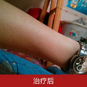 南昌肤康门诊部怎么样 连锁品牌 皮肤专科