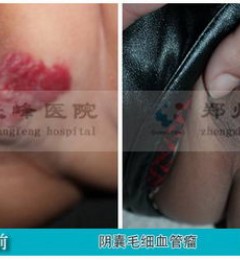 ʲô˽⼸֢״ǾҪѪˣ