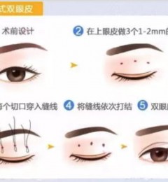 ��ʽ����˫��Ƥ��һ�����ھͻָ�����������������Ժ��