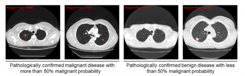 THE OncologistѶͼAIν簩ɸȡоͻ