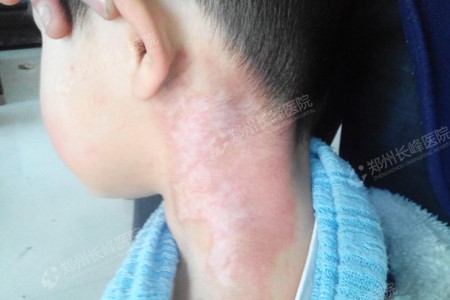 ڵʺʲôı֢״أ֣ݳҽԺ