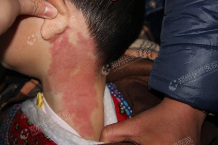 ڵʺʲôı֢״أ֣ݳҽԺ