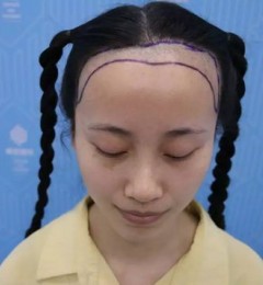 ֲҽԺٰ΢ֱֲֳһ֤ͬɱ䣡