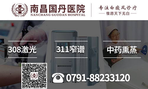 南昌国丹医院告诉你白癜风有哪些共同的症状