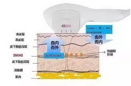 抗衰应该选择什么医美项目,北京伊美尔爱康医院解答