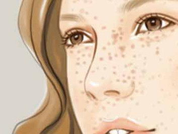 抗衰应该选择什么医美项目,北京伊美尔爱康医院解答