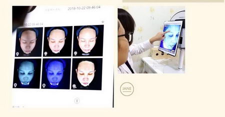 抗衰应该选择什么医美项目,北京伊美尔爱康医院解答