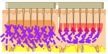 抗衰应该选择什么医美项目,北京伊美尔爱康医院解答