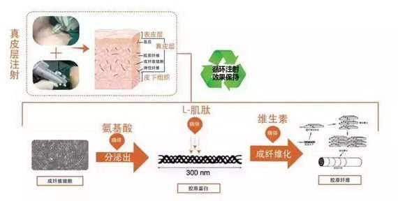 北京伊美尔爱康医院:嗨体注射后的效果能维持多久