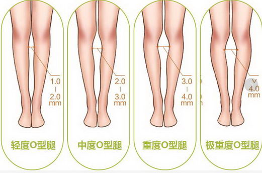 ֪ĲԺOȽ ħȡȲۺϽ