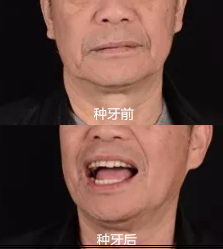 ȷ65ʥǻALL-ON-4ֲ4ؽ