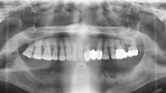 ȷ65ʥǻALL-ON-4ֲ4ؽ