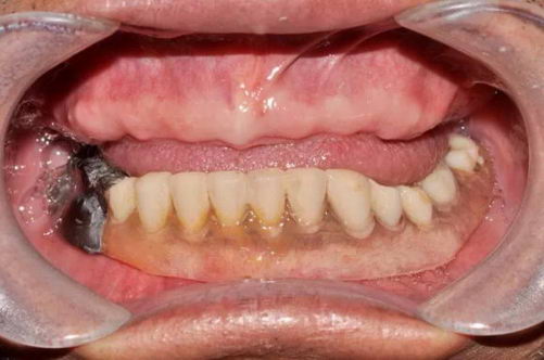 77ȱŶ꣬ȷʥǻall-on-4ֲػڸ