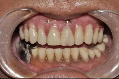 77ȱŶ꣬ȷʥǻall-on-4ֲػڸ