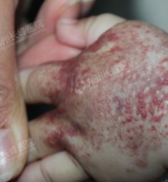 ѪΣж𣿡֣ݳѪҽԺ