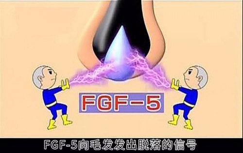 人类脱发的终极元凶被找到?原来都是基因惹的祸!