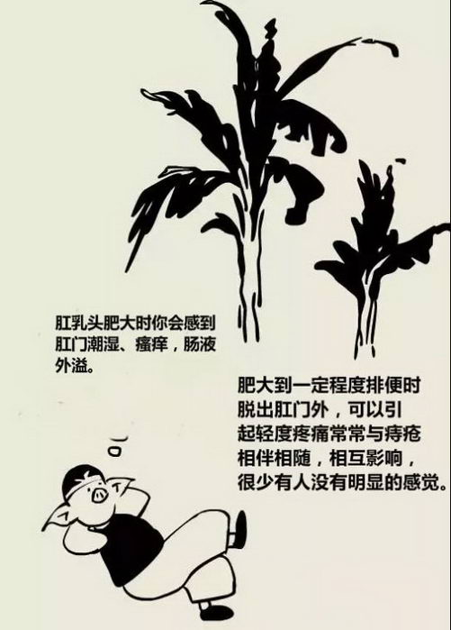 北京丰益肛肠医院科普——肛乳头肥大漫画图解