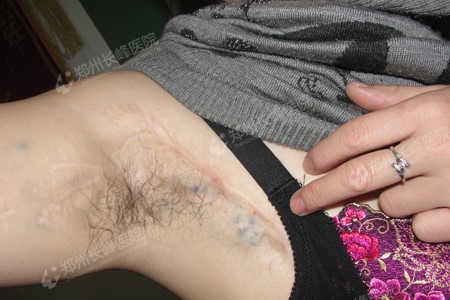 ֹ۵̬ȥƺ״Ѫ֣ݳѪҽԺ