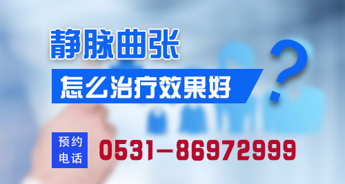 静脉曲张济南哪个医院比较好