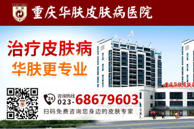 重庆华肤皮肤病医院_透明合理收费正规