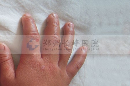 ֣ݳѪҽԺΪָѪӦô?