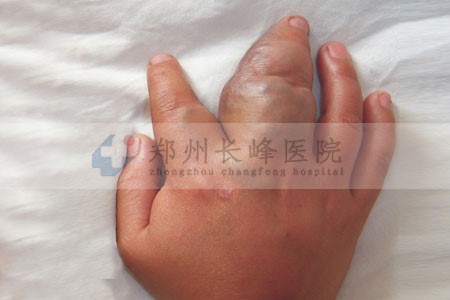 ֣ݳѪҽԺΪָѪӦô?