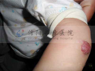 첲ϳѪ᲻ԼʧѪҽԺ