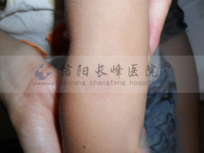 첲ϳѪ᲻ԼʧѪҽԺ