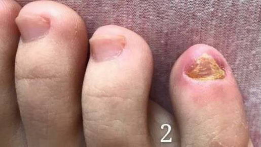 ����������ƽ�־�Һ��Ŀ����޸���ָ����