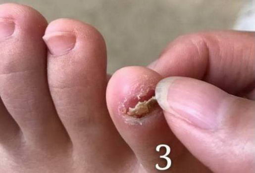 ����������ƽ�־�Һ��Ŀ����޸���ָ����