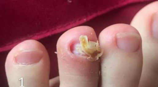 ����������ƽ�־�Һ��Ŀ����޸���ָ����