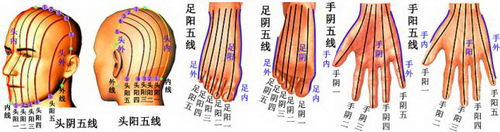 陈氏五线针刺法创始人——陈序选