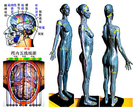 陈氏五线针刺法创始人——陈序选