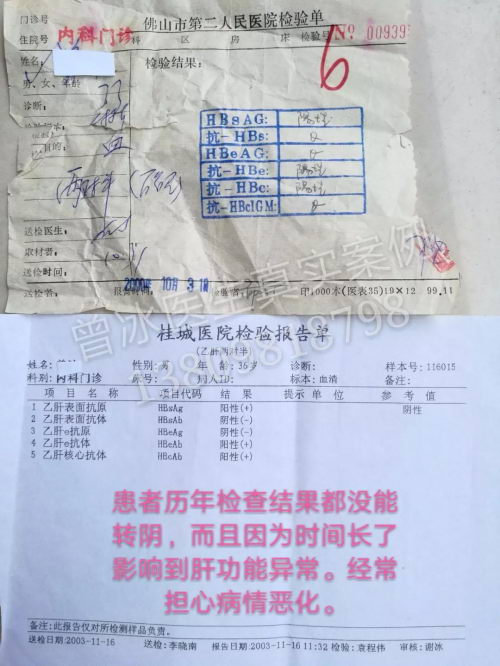 曾冰医师 解决治疗乙肝 肝癌的技术难题