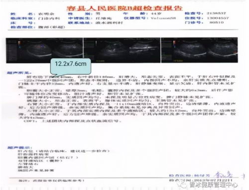 曾冰医师 解决治疗乙肝 肝癌的技术难题