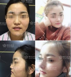 ����ͮ��������Ժ��������ô�� ����ͦ����Ů��