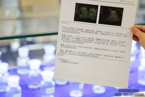 Улȡʯ߶ĴʯҽԺһ