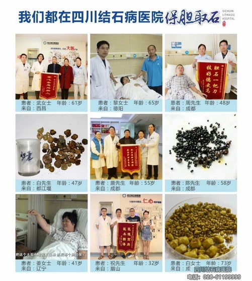 Улȡʯ߶ĴʯҽԺһ