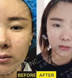 ��С�����Ժ����ע���������ӵķ�������Щ