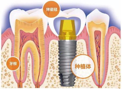 ŵǻҽԺ 򼽿ǻ油ƻ ʽ