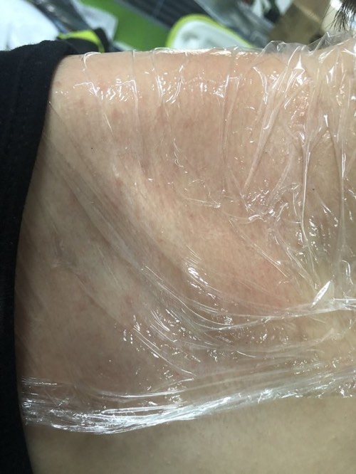 百山百草增效抑菌液家用式理疗