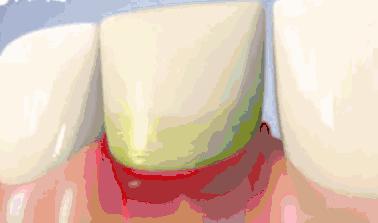 ¹κüǧ̫ܱҽԺշع