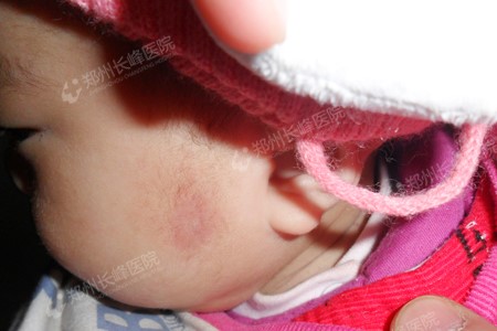 ϵѪʲô֢״֣֣ݳѪҽԺΪ㽲