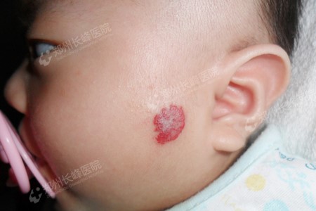 ϵѪʲô֢״֣֣ݳѪҽԺΪ㽲