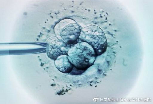 祁秀娟医生告诉您:永远幸的技术支撑优势有哪些?