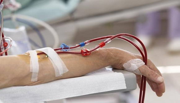 临时透析能治愈的疾病,却变成长期透析?循经护肾疗法须了解!